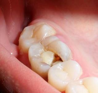 合肥包河区好的牙科？