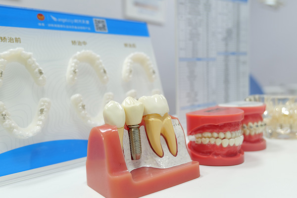 什么是倒牙牙齿敏感能治吗?