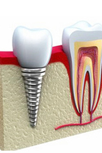 引起牙疼的常见因素？