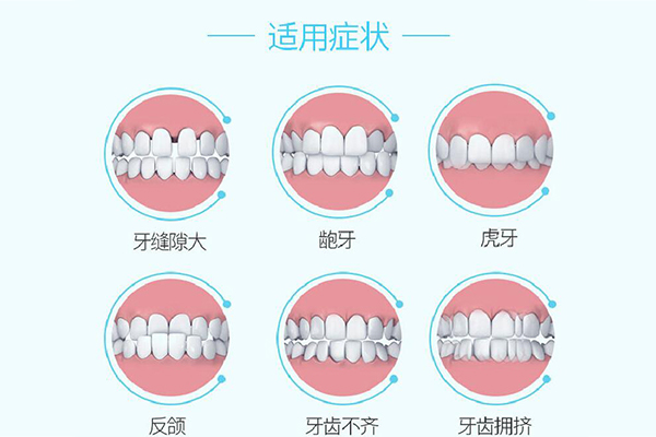 牙齿矫正价格