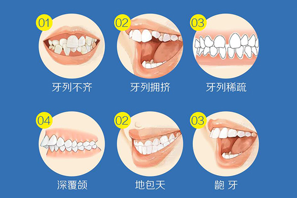 牙齿畸形情况有哪些