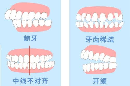 合肥整牙哪家牙科好