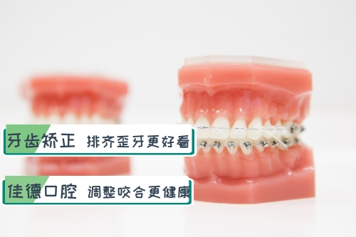 合肥牙齿矫正、合肥佳德口腔