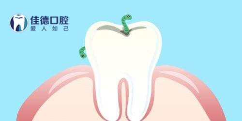 合肥儿童补牙多少钱？
