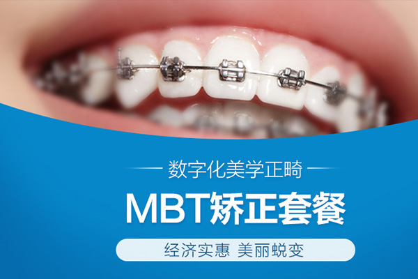 合肥牙齿矫正价格