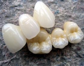 合肥包河区烤瓷牙多少钱？