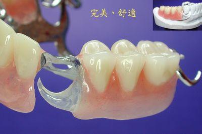 活动假牙的护理方法有哪些?