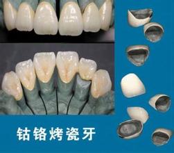 烤瓷牙牙齿矫正方向是怎么样的？