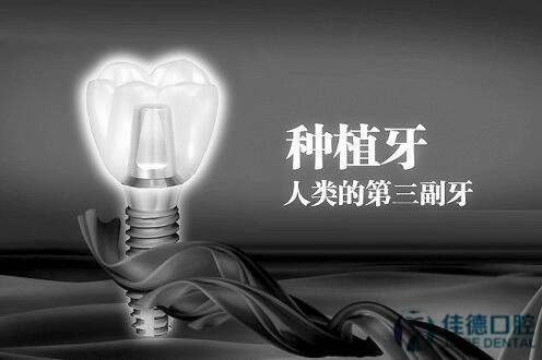 合肥种植牙的费用