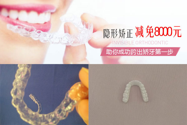 牙齿矫正价格