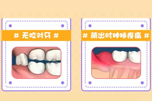 合肥拔牙多少钱一颗