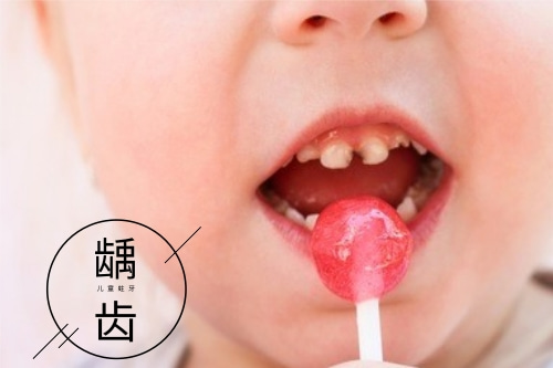 合肥哪个儿童牙科医院好