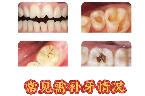 合肥的口腔医院补牙多少钱