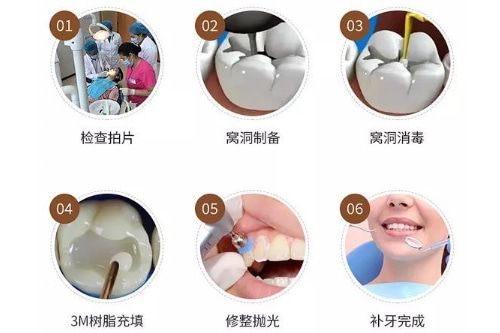 合肥的口腔医院补牙多少钱