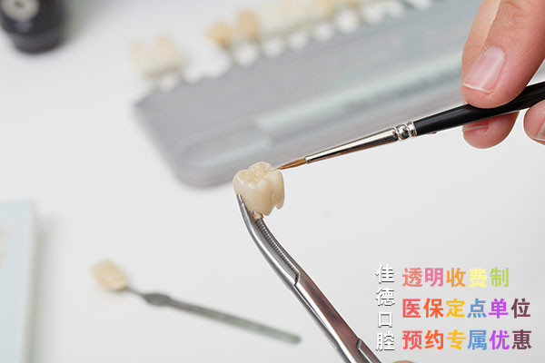 合肥牙冠价格