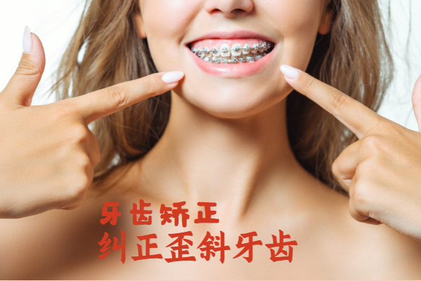牙齿矫正